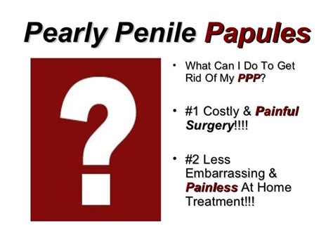 Pearly Penile Papulespearly Penile Papule Removal