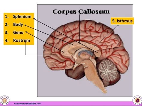 Corpus Callosum Anomalies