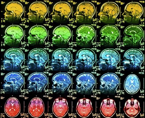 Coloured Mri Scans Of A Healthy Human Brain Photograph By Simon Fraser