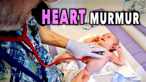 Newborn Heart Murmurs What You Need To Know Dr Paul Youtube