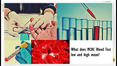 What Does Low Hematocrit Count Mean Hematocrit And Hemoglobin