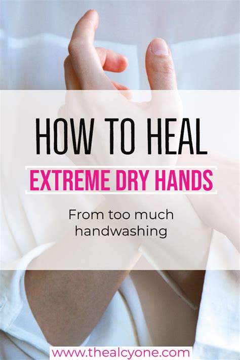 How To Heal Extreme Dry Hands From Too Much Handwashing Extreme Dry