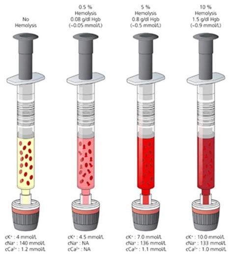 Mix Properly To Reduce Hemolyzed Blood Gas Samples Radiometer