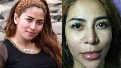 9,177 likes · 6 talking about this. Lakukan Permak Bibir, 4 Artis ini Berubah Drastis, Cantik ...