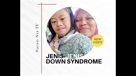 Mengenal Jenis Jenis Down Syndrome Beserta Penyebab Dan Faktor