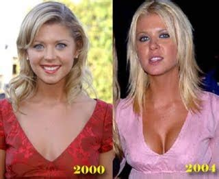The whole experience for me was a completely emotional experience, this emotional journey from beginning to end. A Plastic Surgery: Tara Reid Before And After