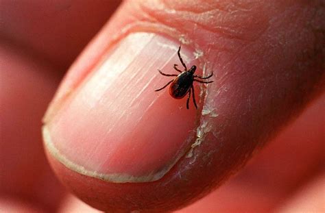 Ticks Suck Heres A Guide To Identifying Them And Avoiding Bites Kqed