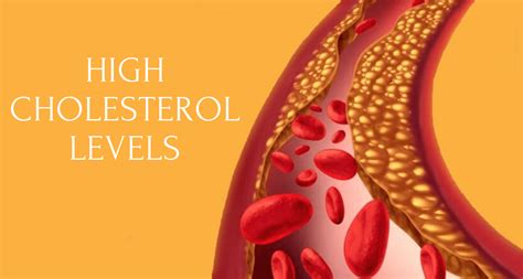 How To Manage High Cholesterol Levels Publishthispost