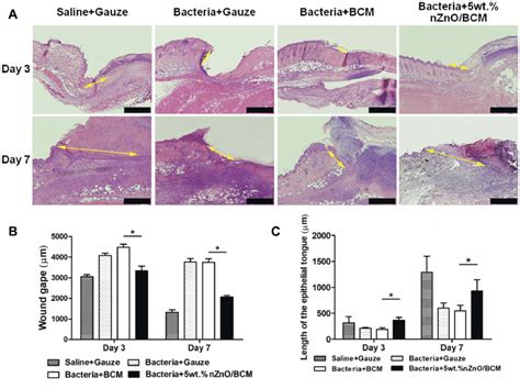 The Effect Of The 5wtnznobcm On Re Epithelialization And Wound