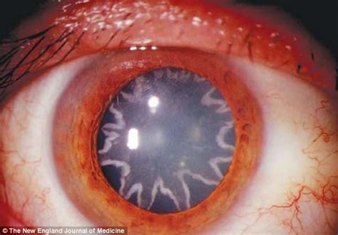 Electrician Left With Stars In His Eyes After Suffering 14000 Volt