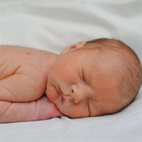 Feeding Infants Newborns With Recessed Chin Micrognathism