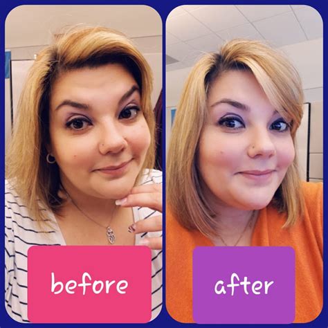 Well, since dermaplaning removes all the little. Monat Results and Reviews - Monat Before and After ...