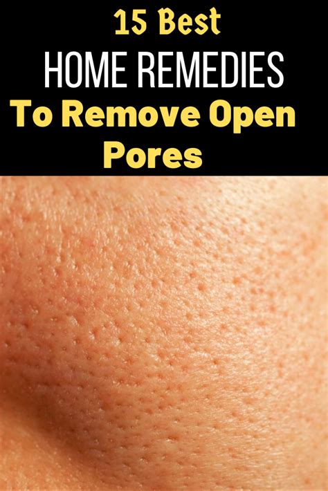 12 Home Remedies For Open Poresget Rid Of At Home Trabeauli In 2020