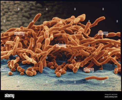 Candida Albicans Coloured Scanning Electron Micrograph Sem Of The