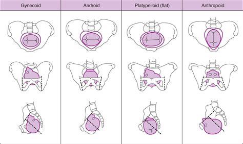 Normal And Abnormal Labor Delivery Current Diagnosis Treatment