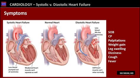Systolic Versus Diastolic Heart Failure By Nik Nikam Md Youtube