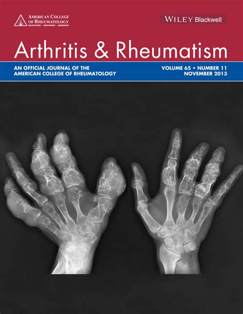 Arthritis And Rheumatism Vol 65 No 11
