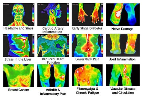 Medical Thermography Imaging Spring Oasis Bringing Oasis To You