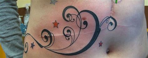Can You Tattoo Over Scars And Scar Tissue Authoritytattoo