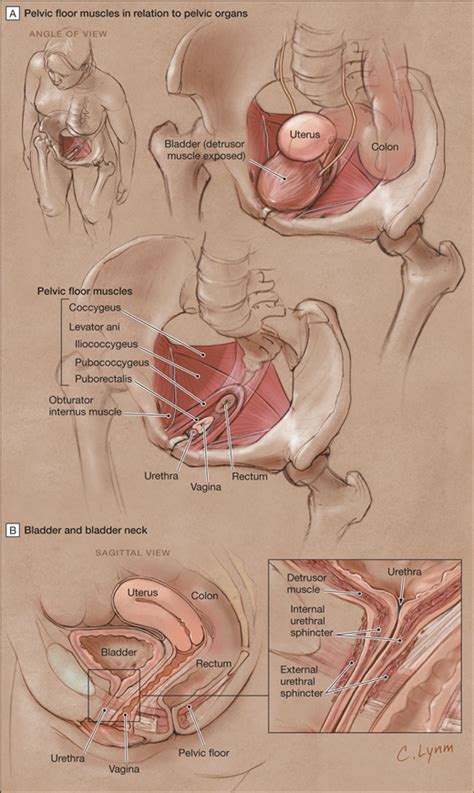 Computer artwork showing the kidneys and female reproductive system. What Type of Urinary Incontinence Does This Woman Have? | Geriatrics | JAMA | JAMA Network