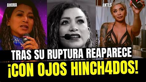 Paula Arias Reaparece Afónica Y Con Ojos Hinch4dos Tras Ruptura Con Eduardo Rabanal Youtube