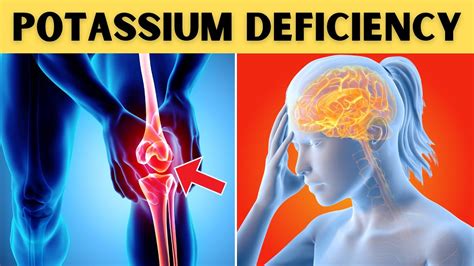 10 Signs You Have A Potassium Deficiency Youtube