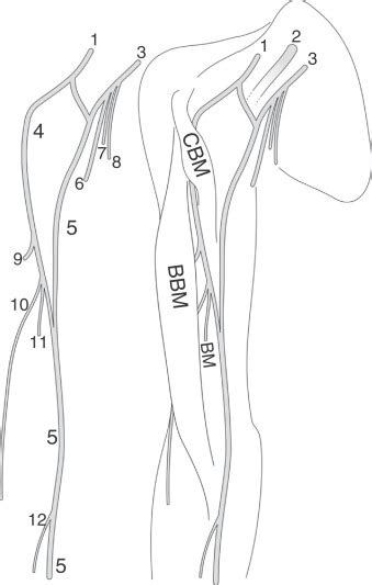 Schematic Illustration Of The Anatomical Variation Of The Download