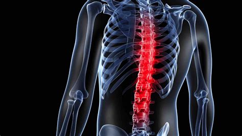 Ankylosing Spondylitis Symptoms Causes And Treatments