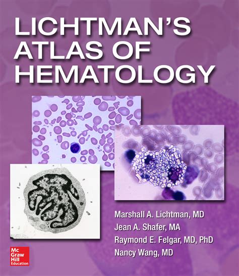 Atlases Hematology Oncology Subject Guides At Cleveland Clinic