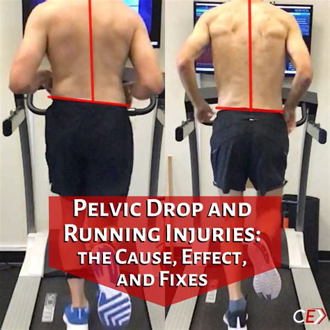 Pelvic Drop And Running Injuries The Cause Effect And Fixes