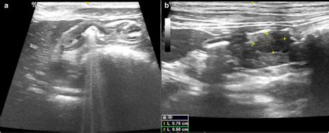 A Case Of Gastric Leiomyosarcoma In A Domestic Shorthair Cat