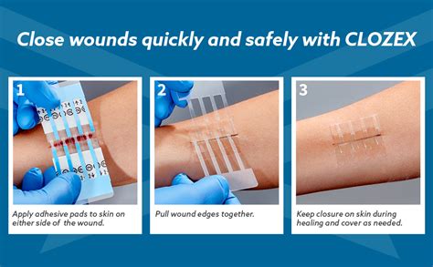 Clozex Emergency Laceration Closures Repair Wounds