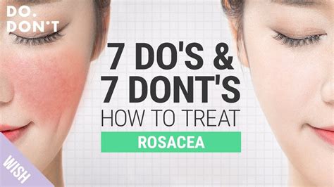14 Tips For Rosacea That Really Work Skin Care