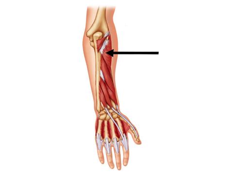 Some are caused by occupational exposures, and are marked with direct professional relation, or the action of harmful effects in the workplace. The muscles of the arm and hand - Anatomy-Medicine.COM