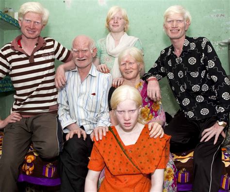 Une famille indienne et albinos