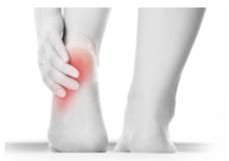 Spina calcaneare, tallonite, fascite plantare - Dott ...
