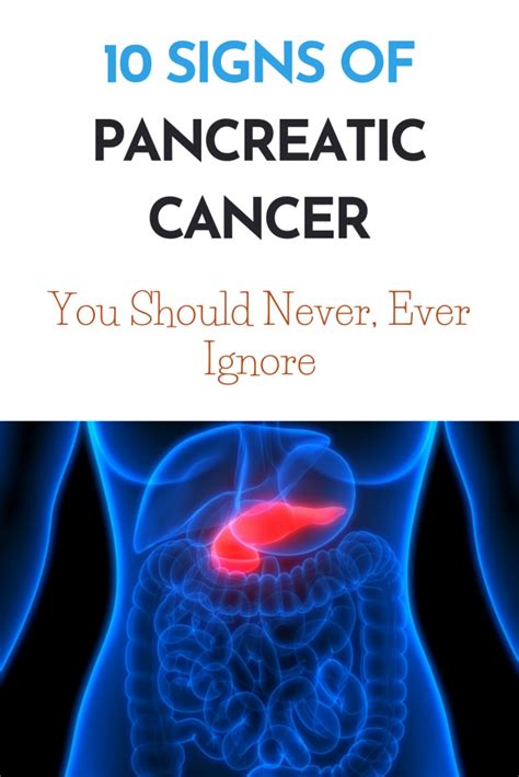 Symptoms can be so vague that you may not notice them. 10 Signs Of Pancreatic Cancer You Should Never, Ever ...