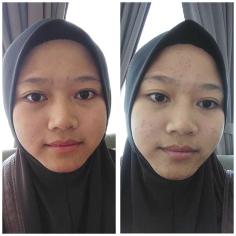 The 1997 version of ko skin specialist was a little clinic located in klang. kisah hidupku...: review selepas sebulan bersama rawatan dr ko