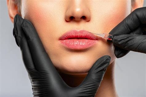 Bótox en los labios Puede aplicarse este tratamiento