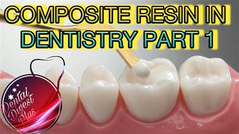 Composite Resin In Dentistry Part 1 Youtube