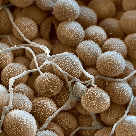 Slime Mould Spores Sem Stock Image B2501060 Science Photo Library