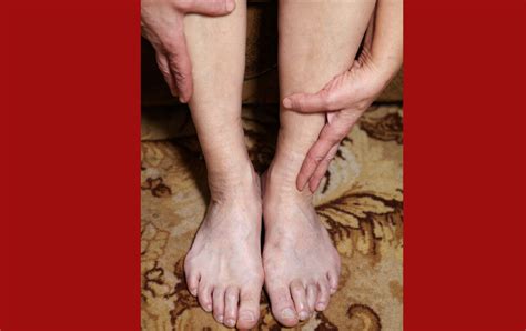 Hair Loss On Legs Warning Sign Of Peripheral Artery Disease PAD
