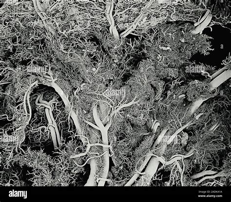 Blood Vessels Scanning Electron Micrograph Sem Electron Microscope My Xxx Hot Girl
