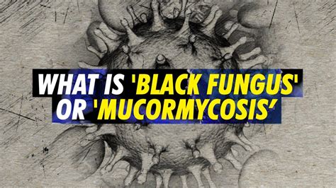 Black Fungus Or Mucormycosis Deadly Fungal Infection Making Some Covid