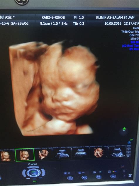 Registered nurse, clinical assistant, dental assistant and more on indeed.com 2D 3D 4D HD 5D scan ultrasound in MALAYSIA list : Bandar ...