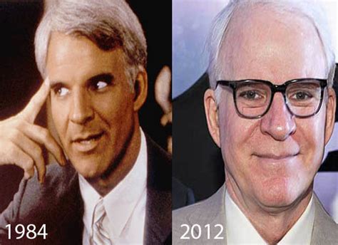 Steve Martin Plastic Surgery Before And After Botox And Facelift
