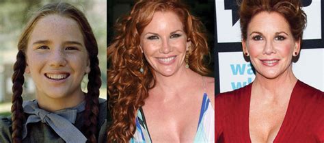 Melissa Gilbert Plastic Surgery Before And After Pictures 2024