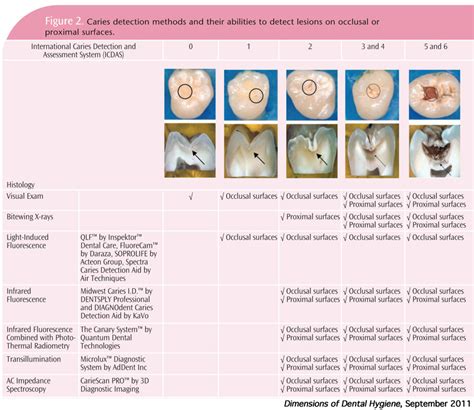 Evolution Of Caries Diagnosis Dimensions Of Dental Hygiene Magazine