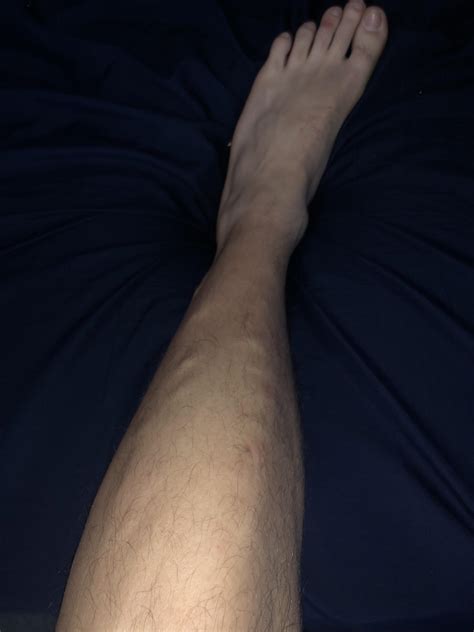 Bumps On My Legs Under Skin Medicaladvice
