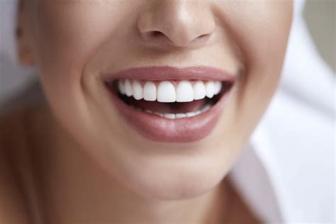 Teeth Whitening Aftercare 7 Dos And Donts To Follow Idental Singapore